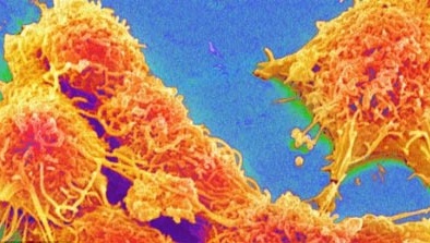 Nuôi thành công khối u tách rời cơ thể